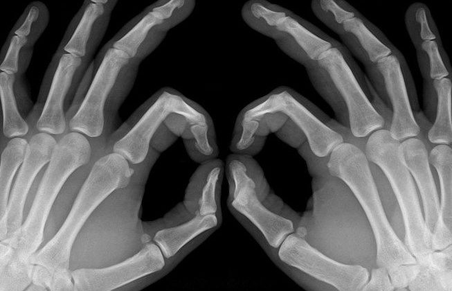 Radiografía Especializada en IMABEN